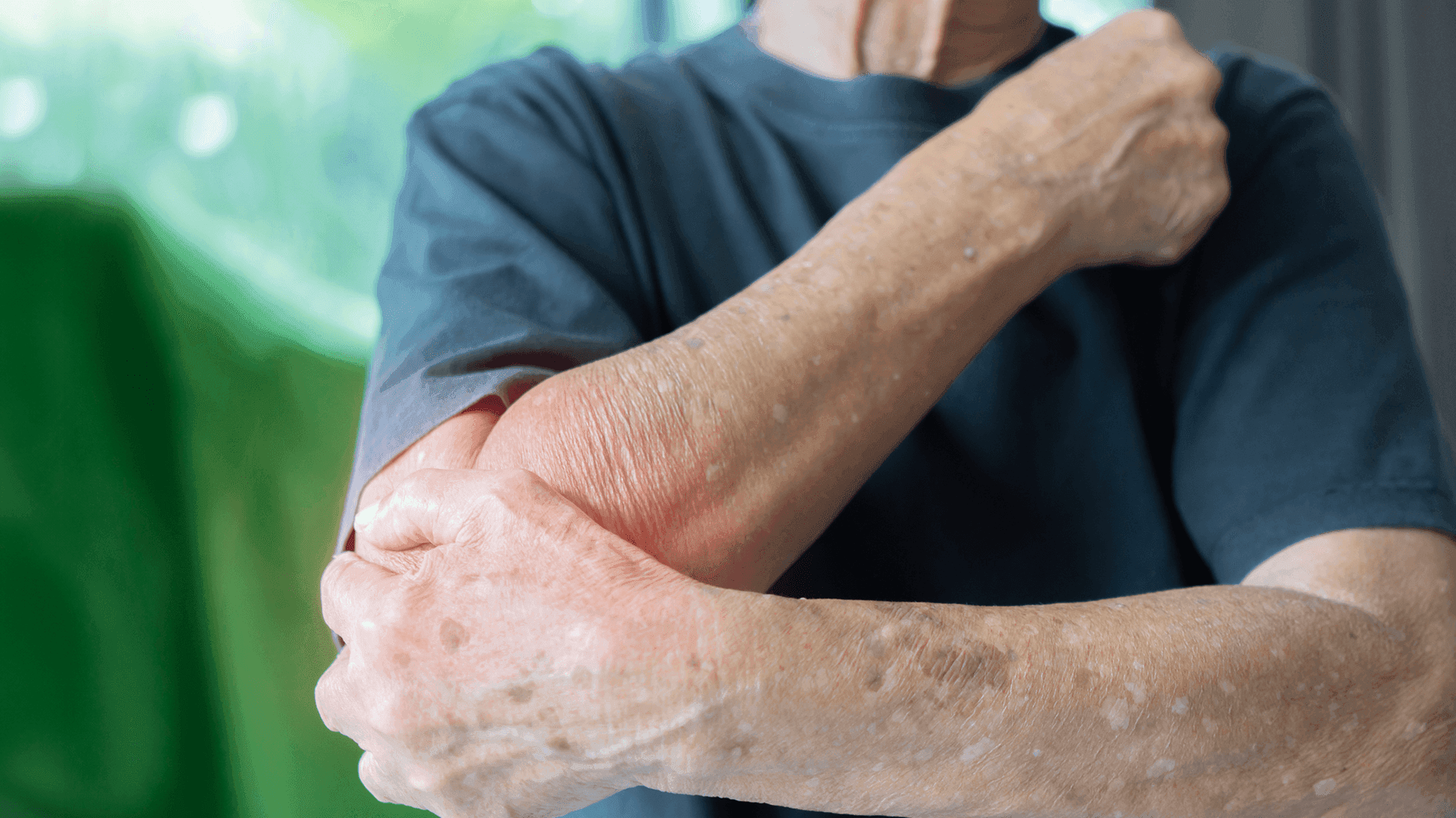 Unmasking systemic mastocytosis: from indolent to advanced stages