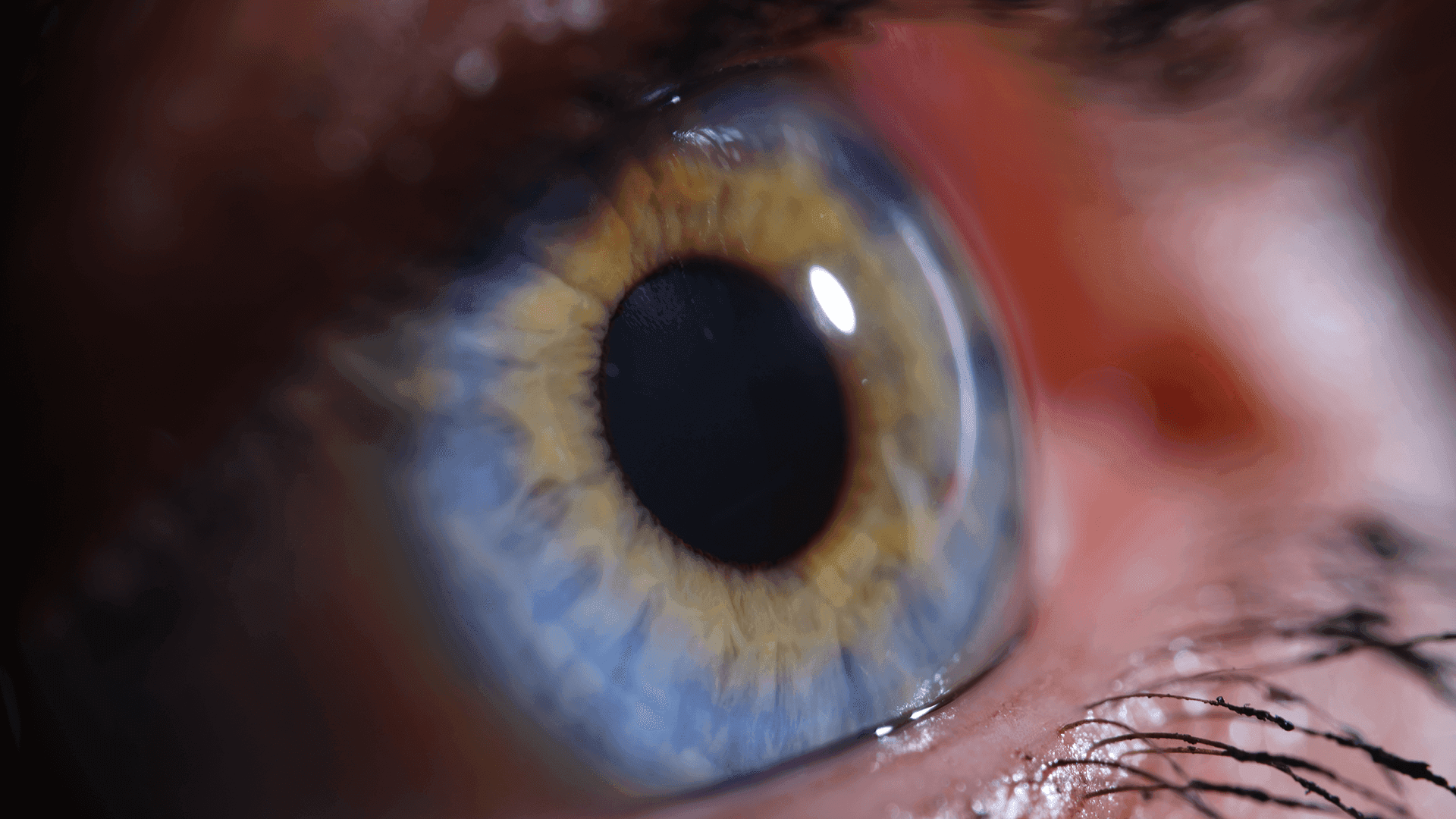 Revolutionizing Care: Breakthroughs in Diagnosing and Treating Diabetic Peripheral Neuropathy|Step Ahead: Essential Foot Care Strategies for Diabetic Peripheral Neuropathy|Bridging the Gap: Enhancing Access and Equity in Diabetic Peripheral Neuropathy Care|The Diagnostic Puzzle: Navigating Differential Diagnosis in Diabetic Peripheral Neuropathy|Bridging the Gap: Enhancing Access and Equity in Diabetic Peripheral Neuropathy Care|Revolutionizing Care: Breakthroughs in Diagnosing and Treating Diabetic Peripheral Neuropathy|Step Ahead: Essential Foot Care Strategies for Diabetic Peripheral Neuropathy