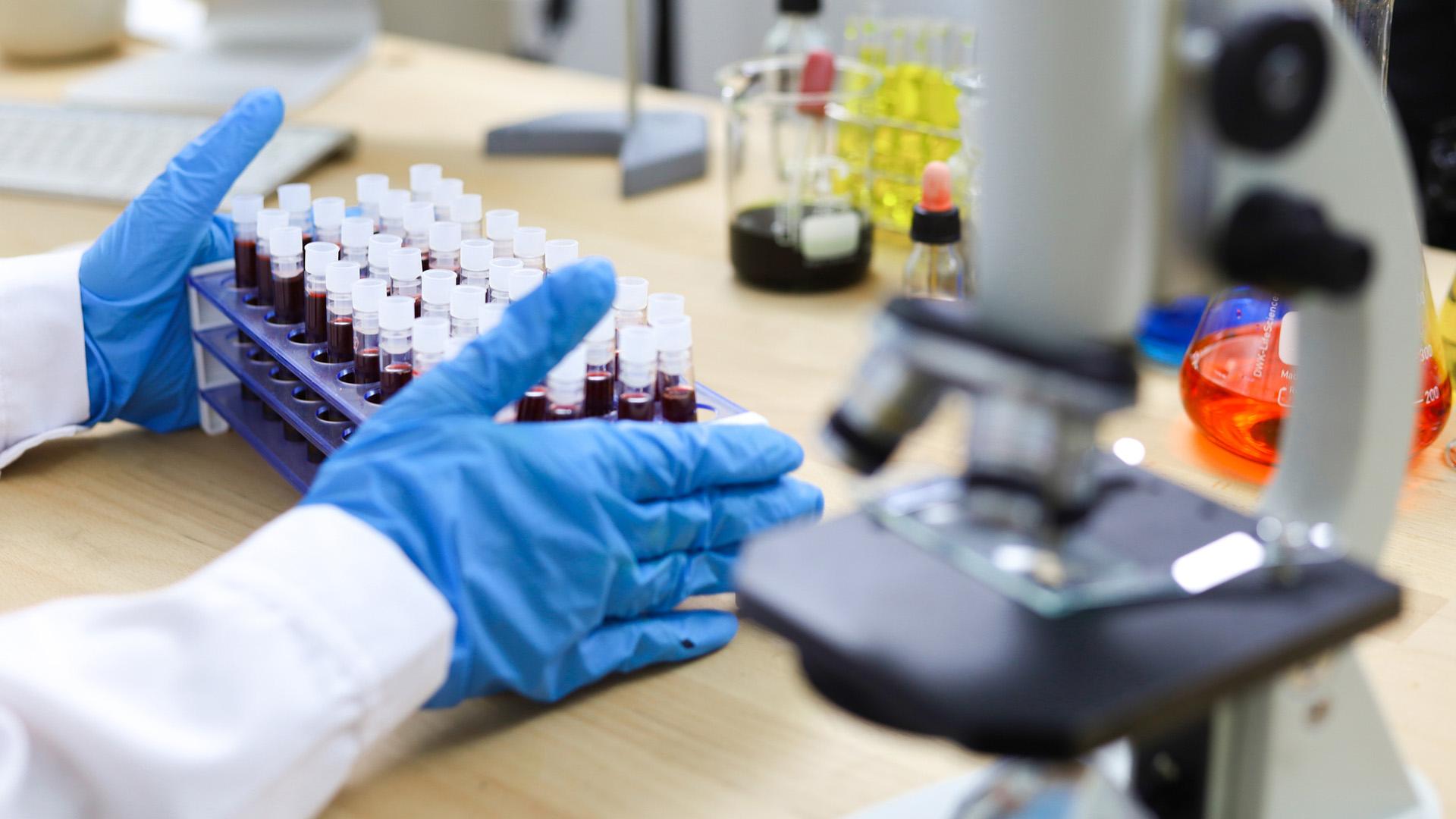 Closing the diagnostic gap: Advancing early Alzheimer’s detection through blood-based biomarkers