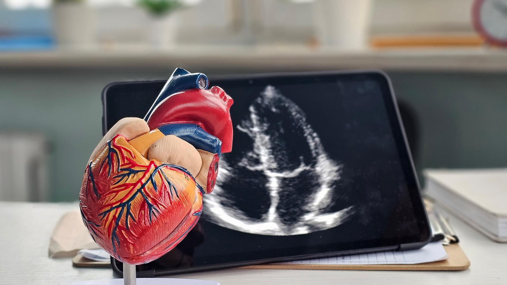 Early TAVR in asymptomatic aortic stenosis: Evolving evidence and practice